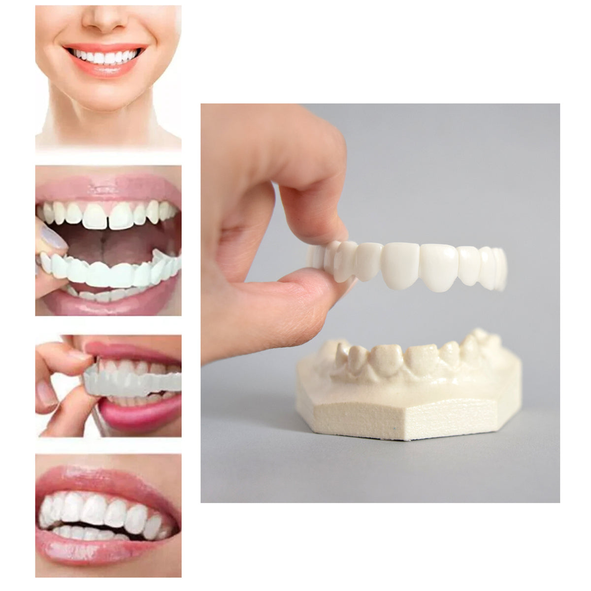 Carillas SnapOn Smile paso a paso