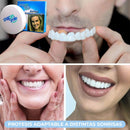 SnapOn Smile 😁 - Carillas Postizas Dentadura